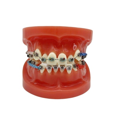 Dental Orthodontic Training Model