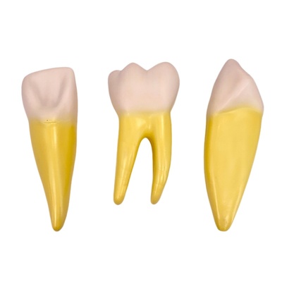 Enlarged Canine, Incisor, and Molar Teeth Model