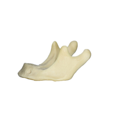 Mandible Implant Practice Model Without Gingiva