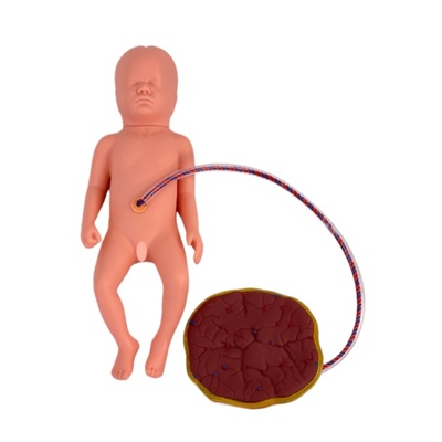 Neonatal Umbilical Cord Placenta Care Model