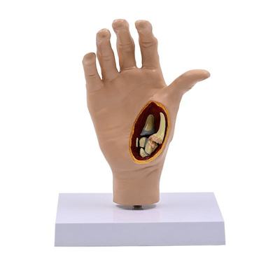 Pathology Hand Model