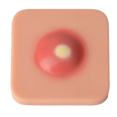 Abscess Incision and Drainage Pad
