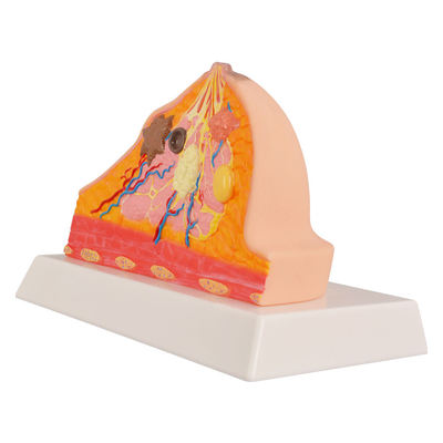 Pathological Breast  Model
