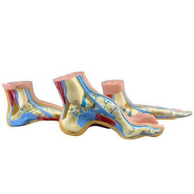 Normal Foot Flat and Arched Foot Anatomy Model