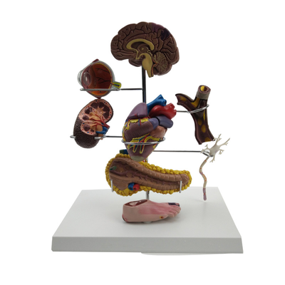 Diabetes model