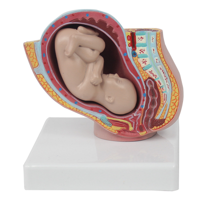 Small pregnancy with a baby in the pelvic cavity
