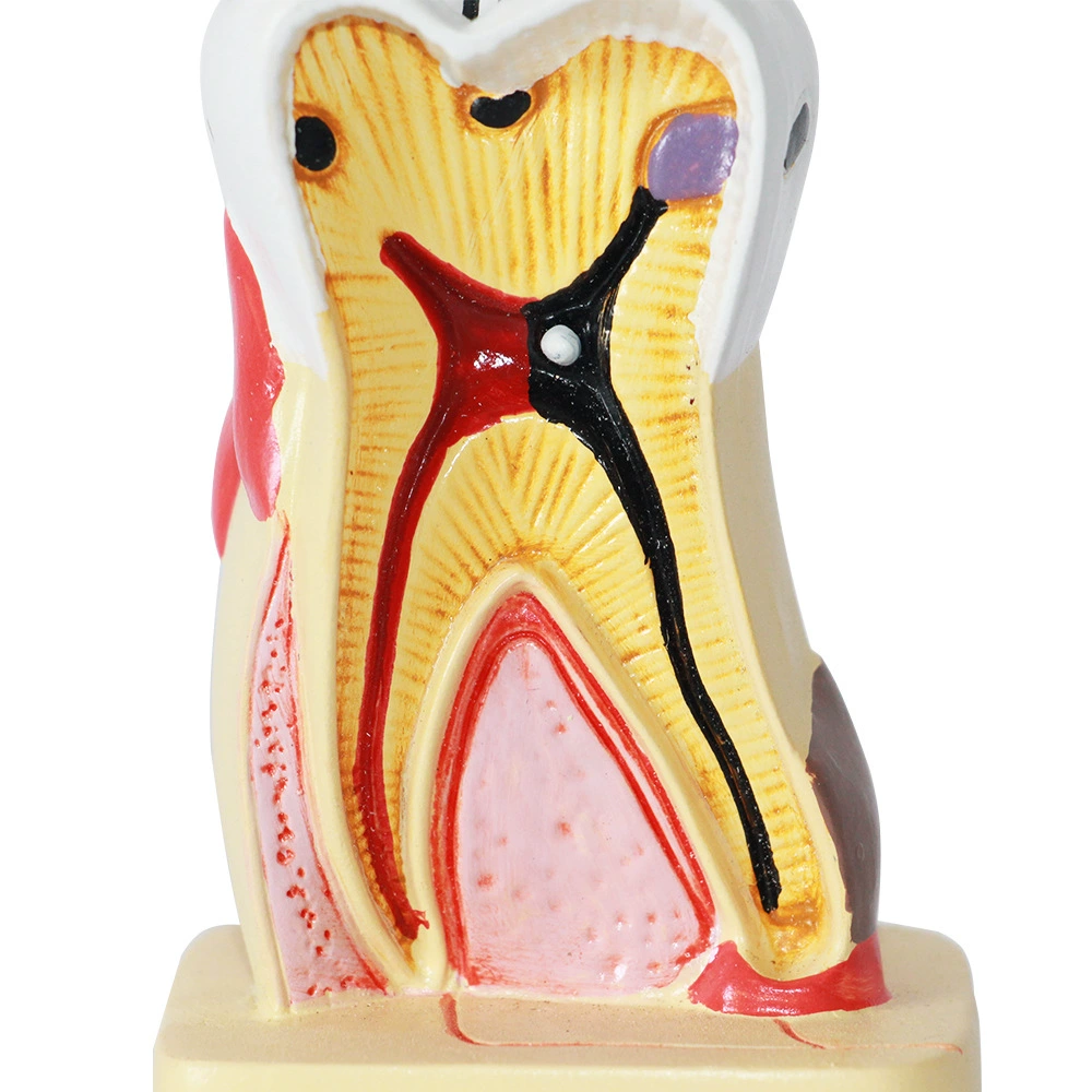 Enlarged Molar Anatomy Model